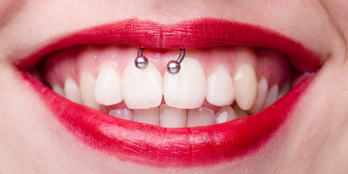 Smiley,Piercing,Detail,With,Smiling,Woman’s,Mouth